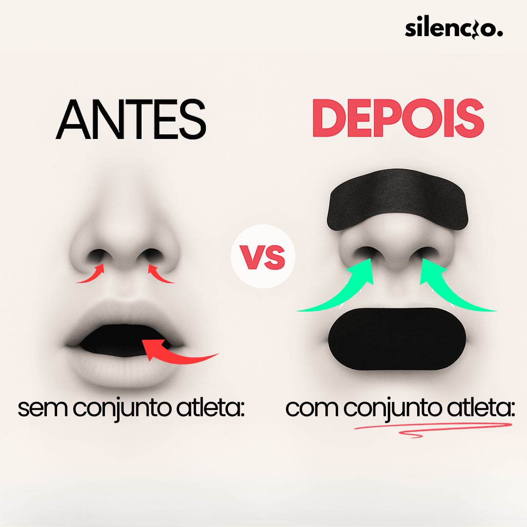 Conjunto Atleta - Silencio