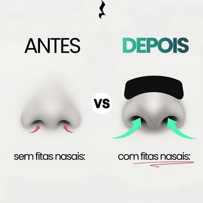 Pack Fitas Nasais